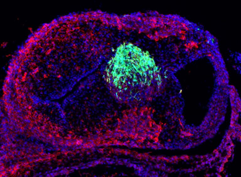 Chick Defects Understanding Congenital Heart Defects, One Chicken at a Time ...