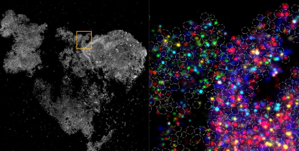 Spatial Expression New Technique Surveys Microbial Spatial Gene Expression Patterns ...