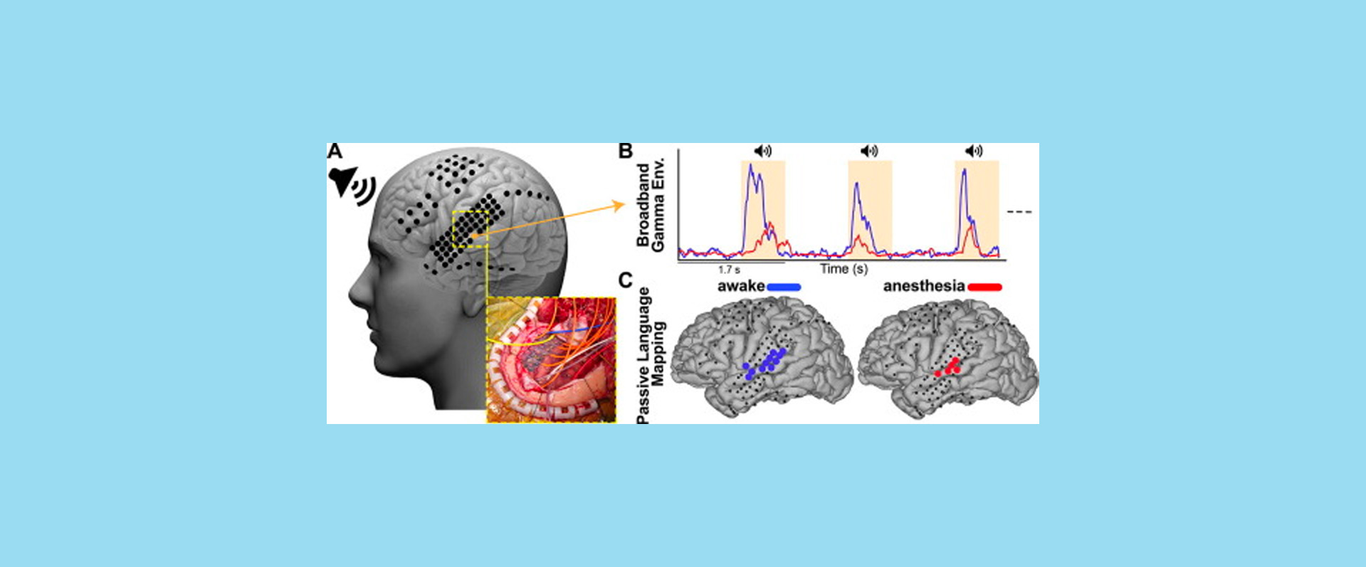Proving the Feasibility of Passive Functional Mapping in the Receptive Language Cortex during General Anesthesia
