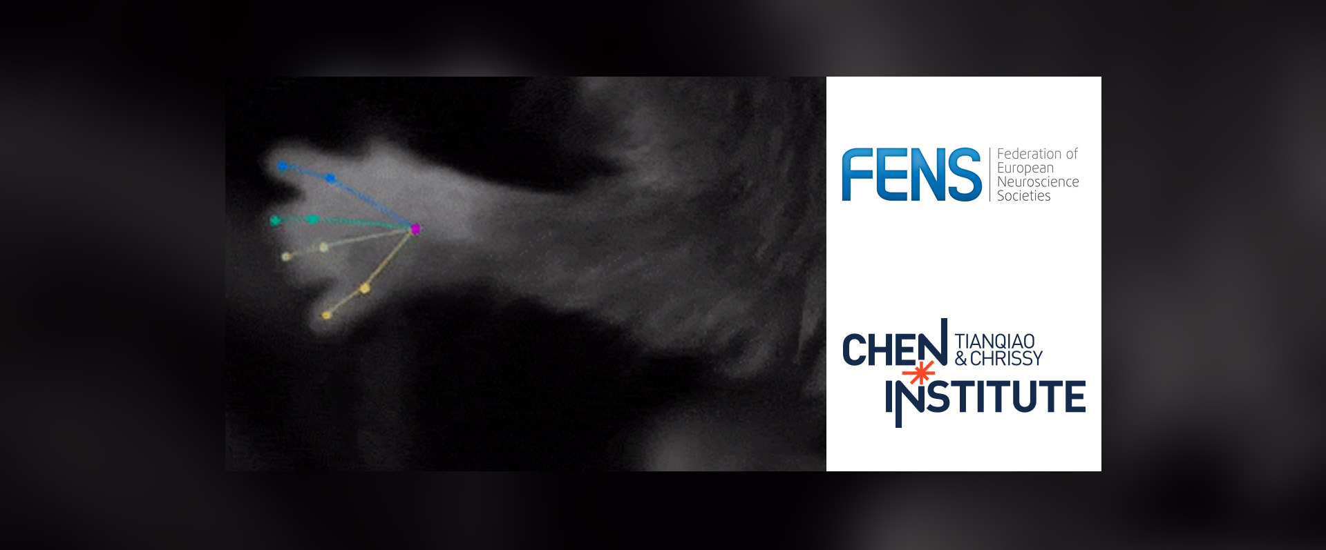 FENS-天桥脑科学研究院合办NeuroLéman夏校，从健康和疾病的视角聚焦大脑动力学