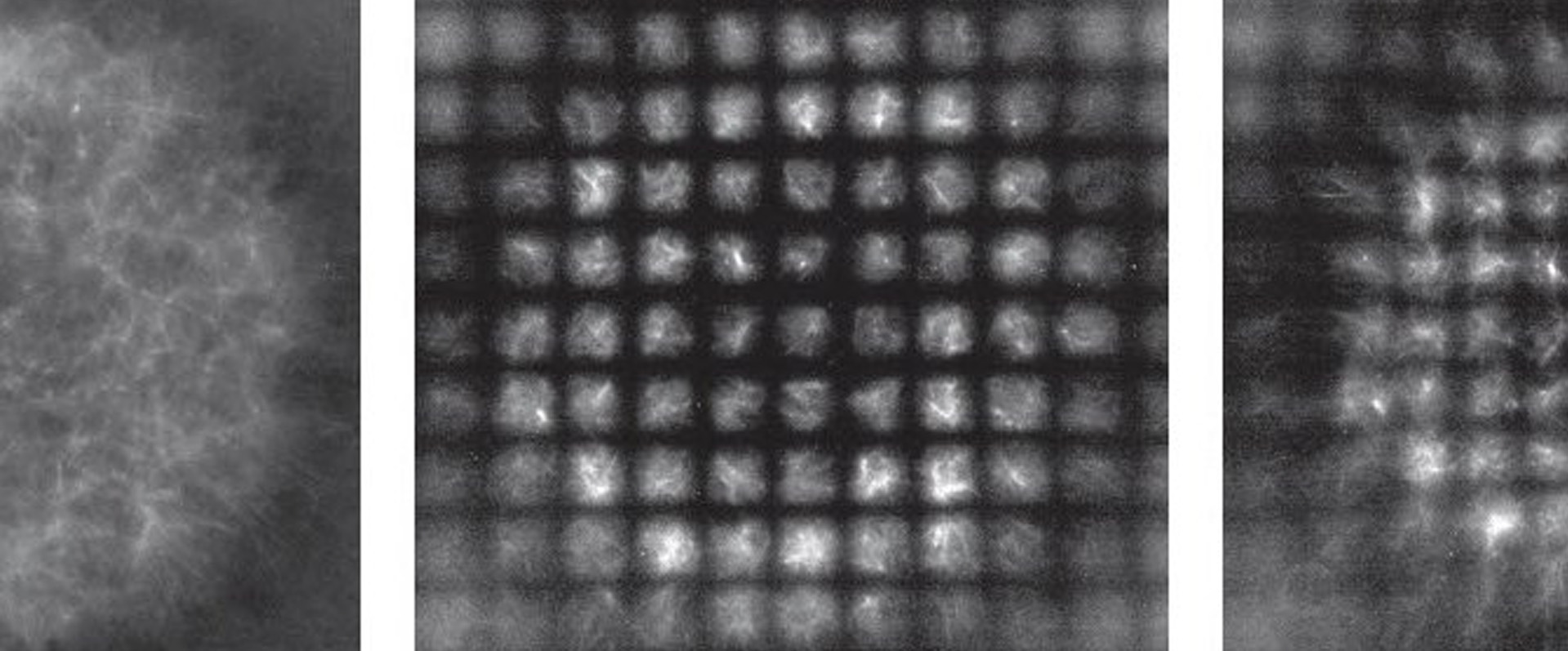 Cellular Coordinate System Reveals Secrets of Active Matter